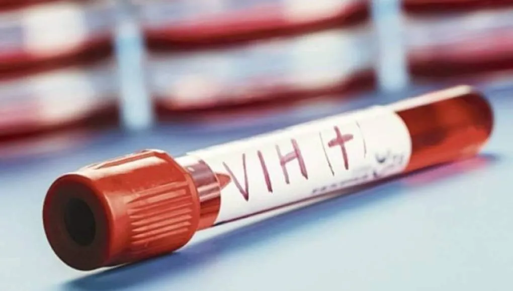 Honduras suma 42,085 casos de VIH desde 1985 tras diagnosticar 918 infecciones en 2023