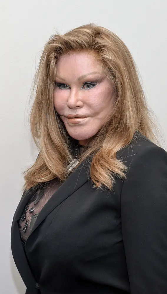 ¿Quién era Jocelyn Wildenstein? - Noticias de hoy en República Dominicana | De Último Minuto