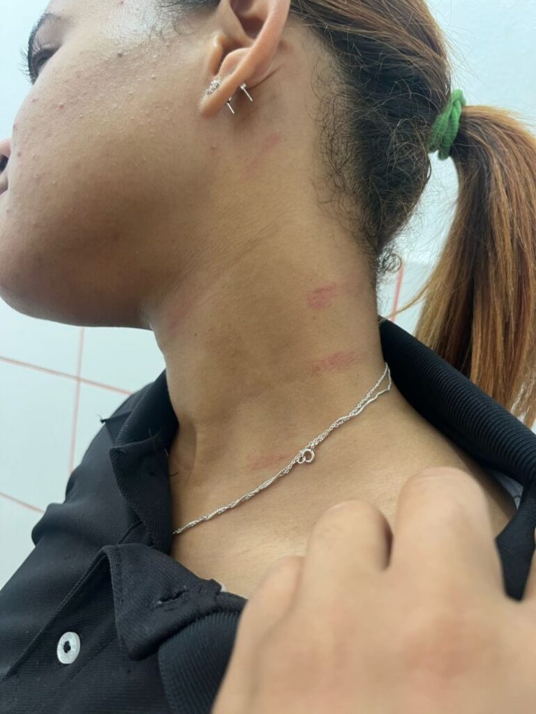 Padre pide agilizar pedimento de medida de coerción contra agresor de su hija  - Noticias de hoy en República Dominicana | De Último Minuto