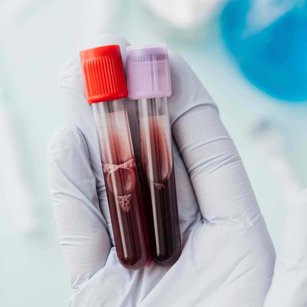 Día Mundial del Cáncer de Sangre: una lucha por la vida y la esperanza