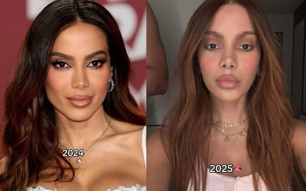 Anitta es tendencia tras supuesto cambio en su rostro - Noticias de hoy en República Dominicana | De Último Minuto