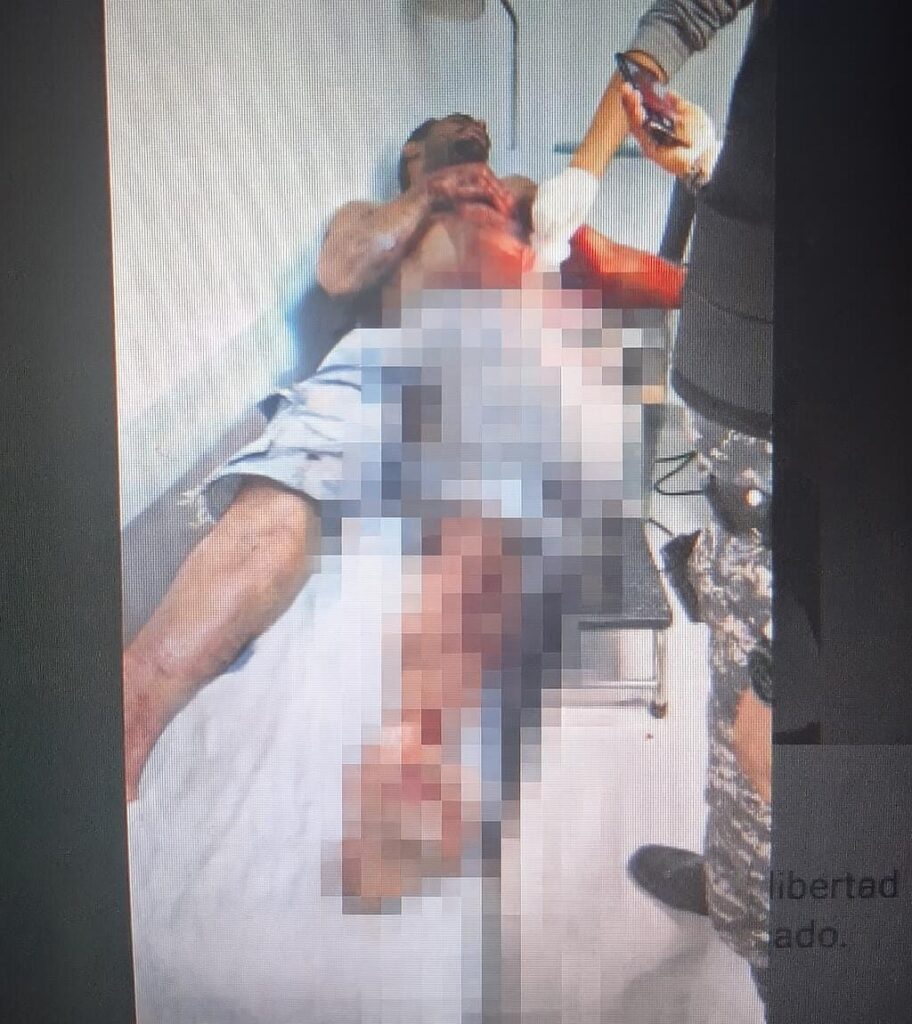 Preso apuñala a otro en cárcel preventiva de la policía en La Vega - Noticias de hoy en República Dominicana | De Último Minuto