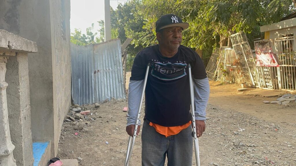 Motoconchista accidentado en Santiago Oeste clama por ayuda para sostener a su familia - Noticias de hoy en República Dominicana | De Último Minuto