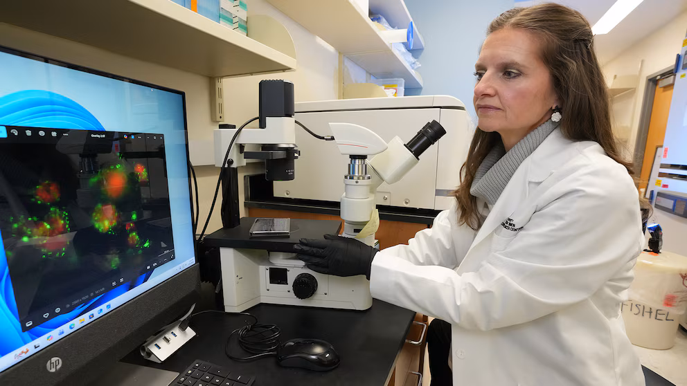 Descubren una proteína sanguínea que podría frenar el avance del cáncer de páncreas - Noticias de hoy en República Dominicana | De Último Minuto