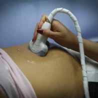 Ultraderecha chilena busca obligar a las mujeres a oír el latido del feto antes de abortar